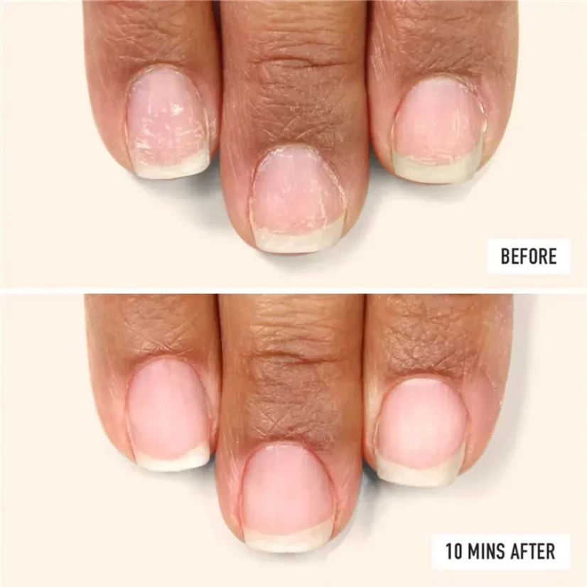 LONDONTOWN Kur Nail Probiotic Instant Boost péče o slabé a tenké nehty   12 ml